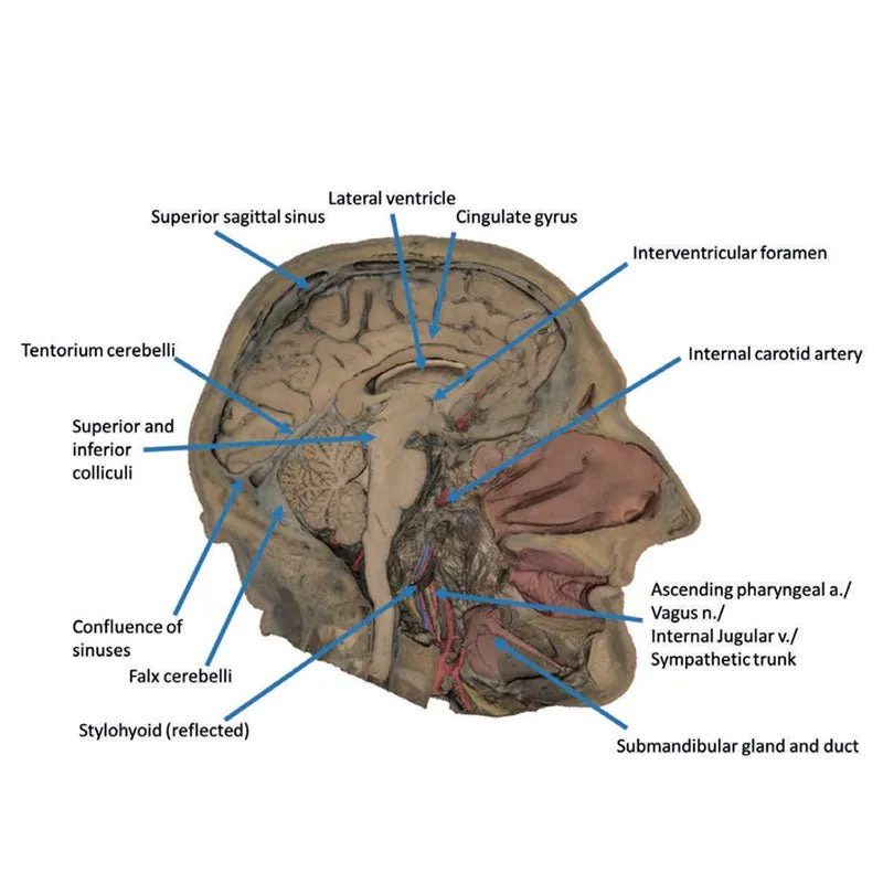3D Printed Median Section Through Head Sagittal Section of Head with Deep Dissection